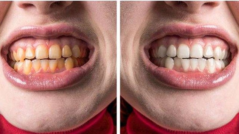 أخطاء شائعة عند تنظيف
